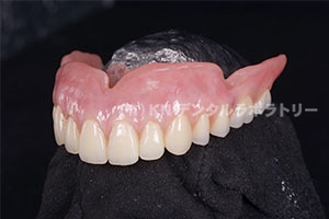 茨城の技工所 (有)KNデンタルラボラトリー｜CAD/CAMデンチャー｜高精度