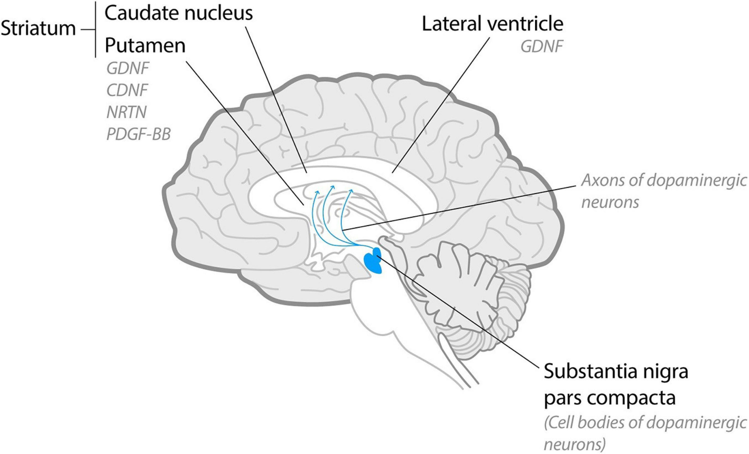 Frontiers | Neurotrophic Factors in Parkinson's Disease: Clinical