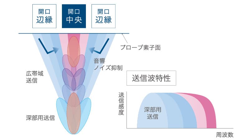 超音波診断装置 SONIMAGE UX1 TRiFOR | コニカミノルタ