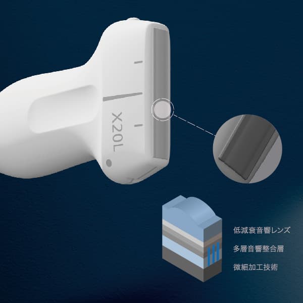 超音波診断装置 SONIMAGE UX1 TRiFOR | コニカミノルタ