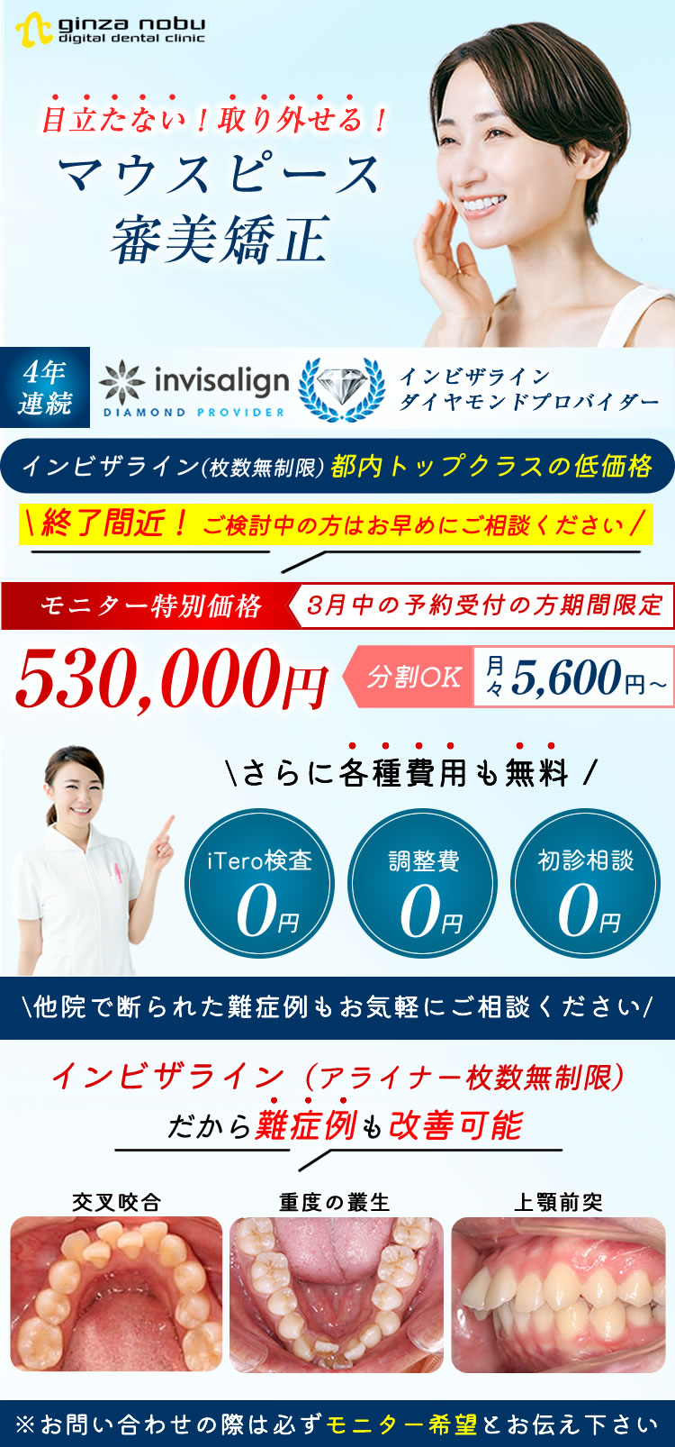 東京銀座53万円！激安マウスピース矯正歯科 インビザラインフル