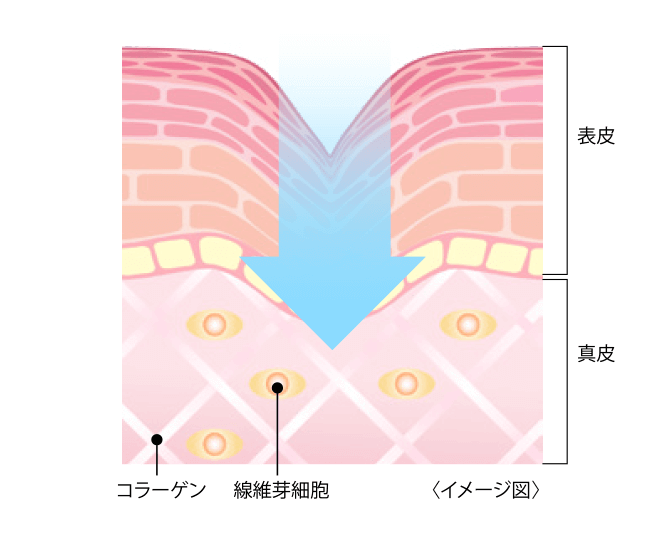 薬用リンクルセラム｜株式会社ノエビア