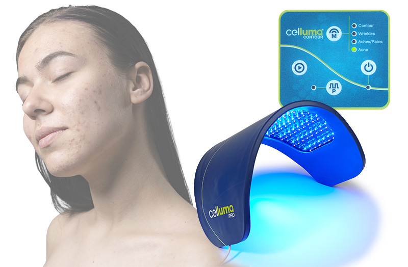 Celluma ELITE LEDライトセラピー | 誠鋼社 セルーマ日本総発売元