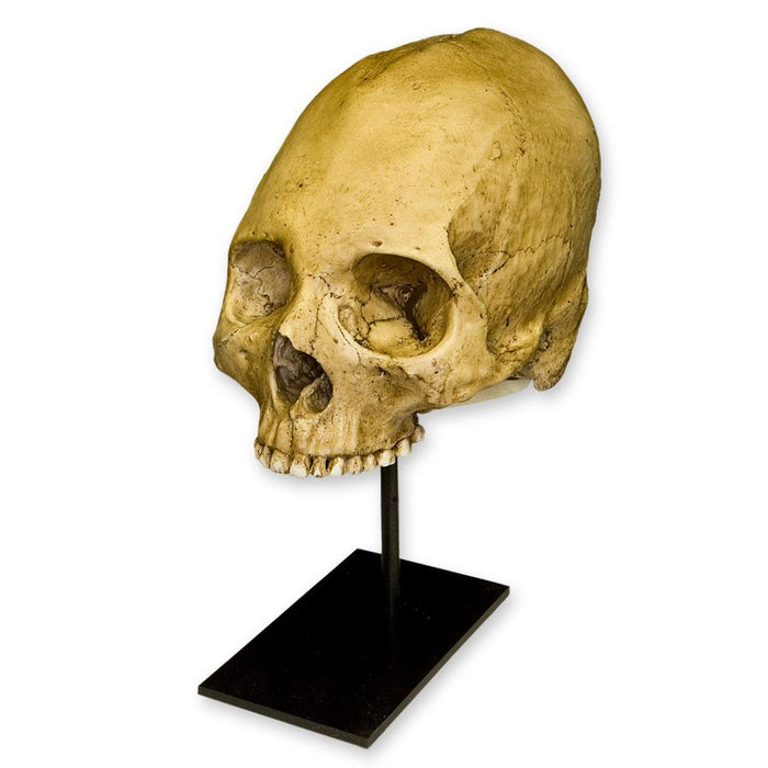 Replica Human Trephined Skull For Sale — Skulls Unlimited