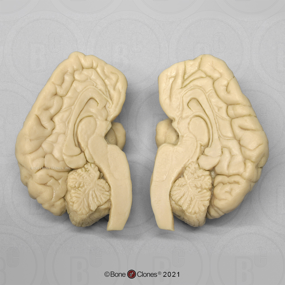 Chimpanzee Brain - Bone Clones - Osteological Reproductions