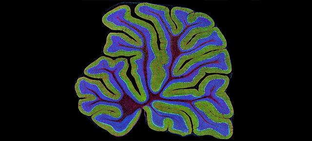 The cerebellum as a source of generalized convulsive seizures
