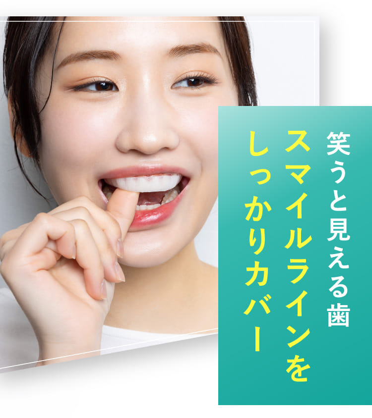 DENNOVATE - ディノベート - TEETH WHITENING GEL PACK ホワイトニング