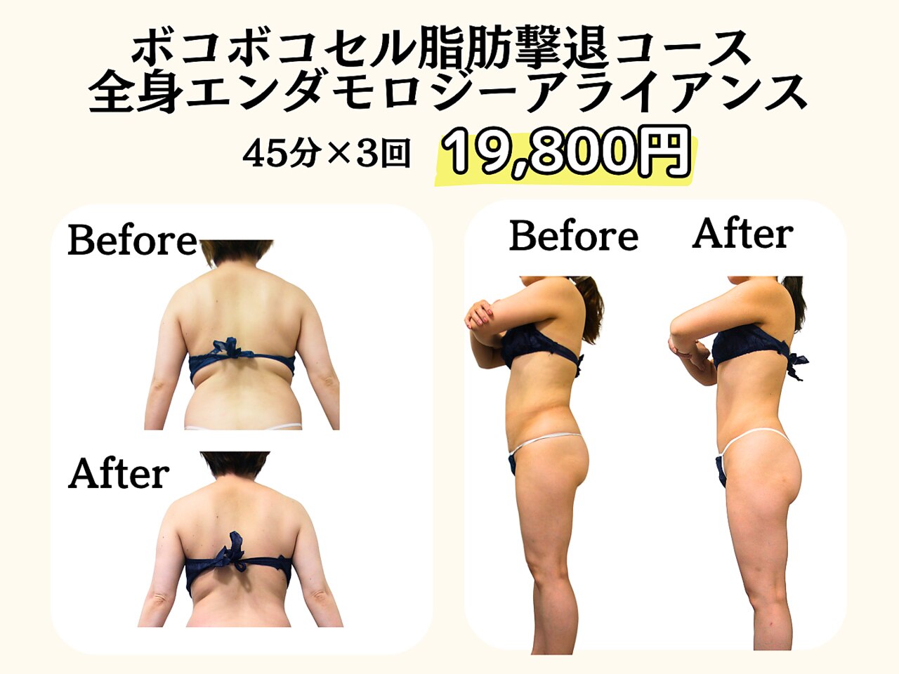 阿佐ヶ谷駅でエンダモロジーが人気のエステサロン｜ホットペッパー
