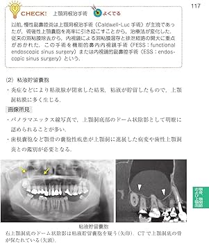 Amazon.co.jp: 歯科国試パーフェクトマスター 歯科放射線学 : 飯久保
