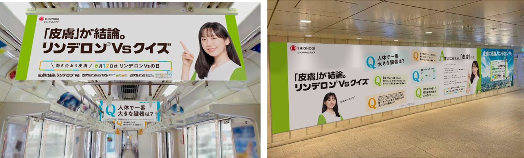 6 月12 日を「向き合おう皮膚【リンデロンVs】の日」に新制定！ ―芦田
