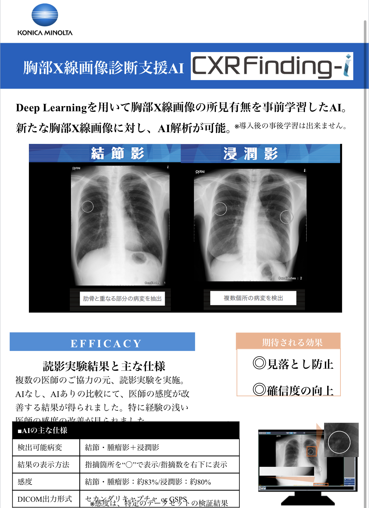 胸部レントゲンAI判定画像診断システム導入しました！ | セタクリニック