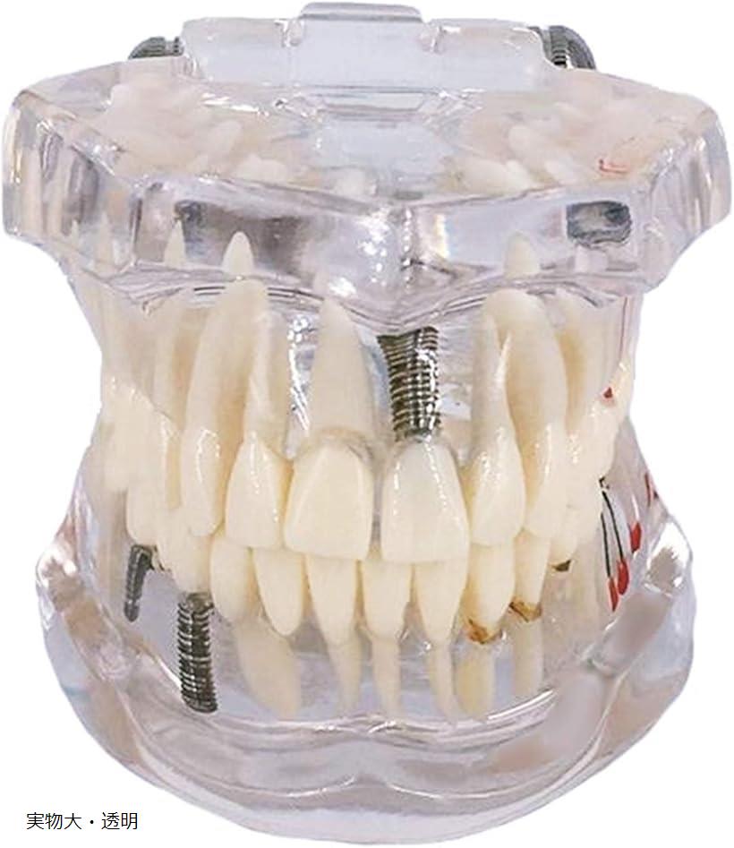 楽天市場】補綴修復用顎模型 (NISSIN DENTAL MODEL) (D16FE-500A(GSF